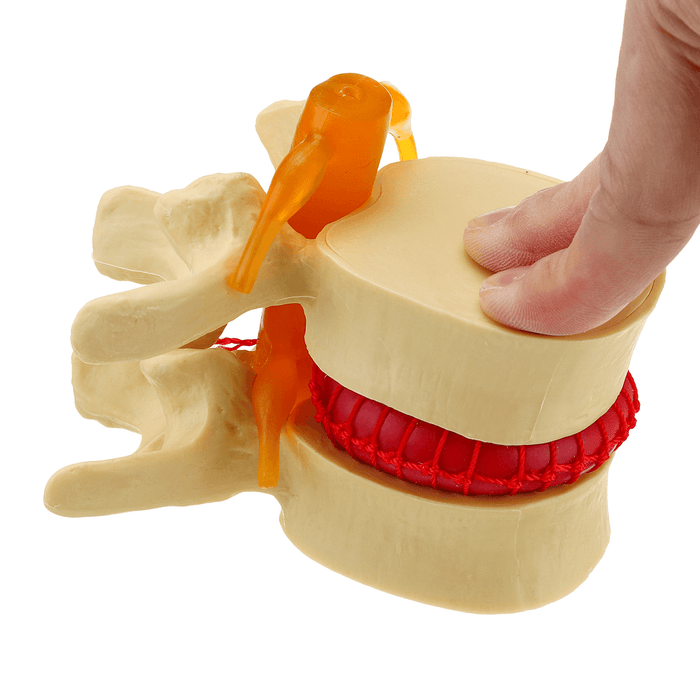 Medical Lumbar Vertebrae Model Props Anatomical Spine Herniation Teaching Tool