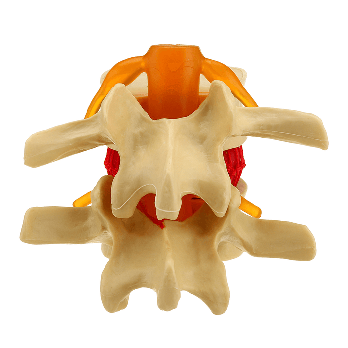 Medical Lumbar Vertebrae Model Props Anatomical Spine Herniation Teaching Tool