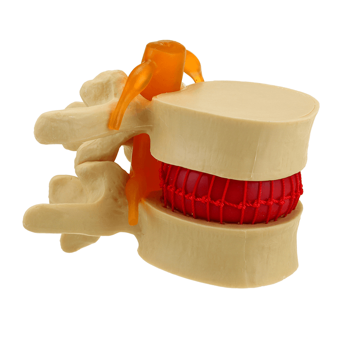 Medical Lumbar Vertebrae Model Props Anatomical Spine Herniation Teaching Tool