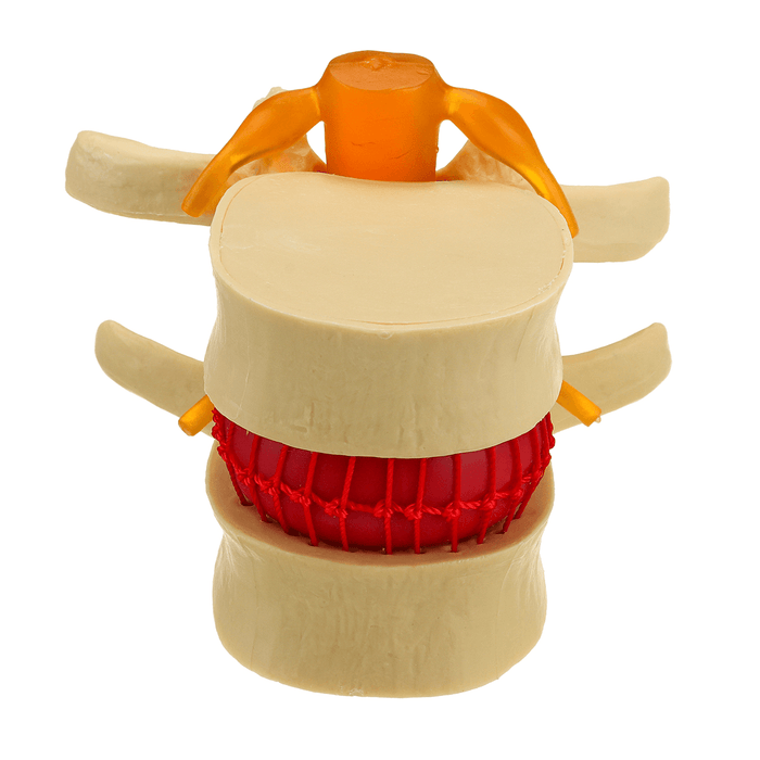 Medical Lumbar Vertebrae Model Props Anatomical Spine Herniation Teaching Tool