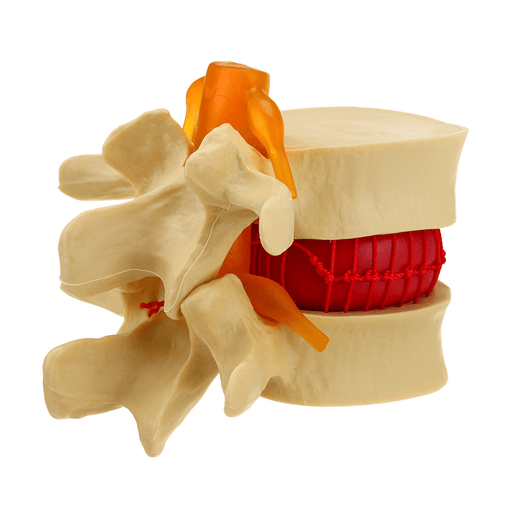 Medical Lumbar Vertebrae Model Props Anatomical Spine Herniation Teaching Tool