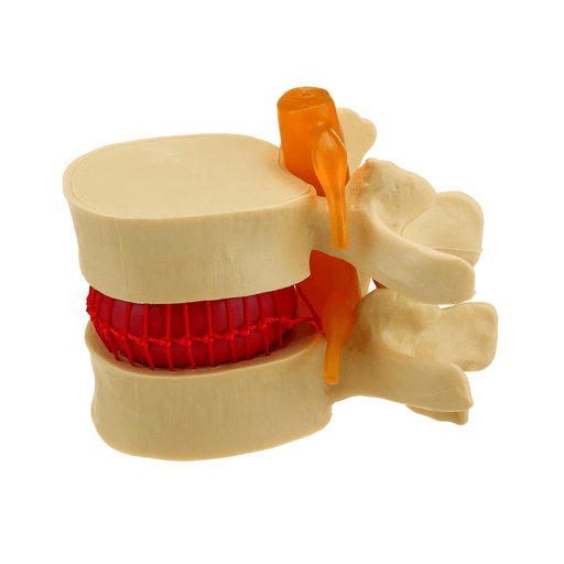 Medical Lumbar Vertebrae Model Props Anatomical Spine Herniation Teaching Tool