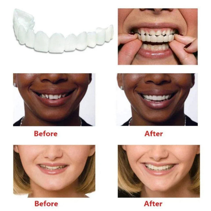 Perfect Fit Teeth Whitening Fake Tooth Cover Snap On Silicone Smile Veneers Teeth Upper Beauty Tool Cosmetic Teeth Free shipping