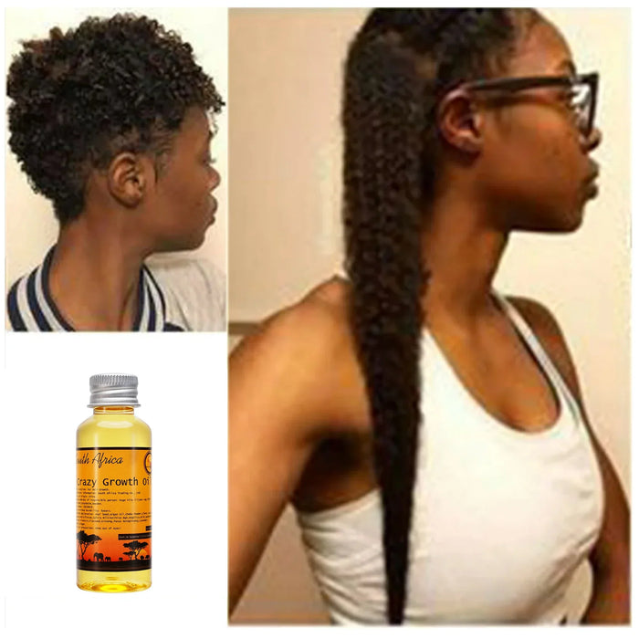 50 ml Traditional African Hair Oil GROW YOUR HAIR FASTER LONGER IN 1 WEEK Helps To Stop Breakage Moisturise Promotes Hair Growth