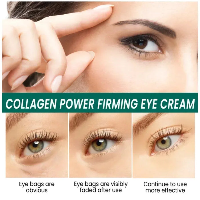 7 Day Tighten Wrinkles Eye Cream Anti Dark Circles Bags Puffiness Fade Eye Fine Line Whiten Under Eyes Skin Korean Care New 2024