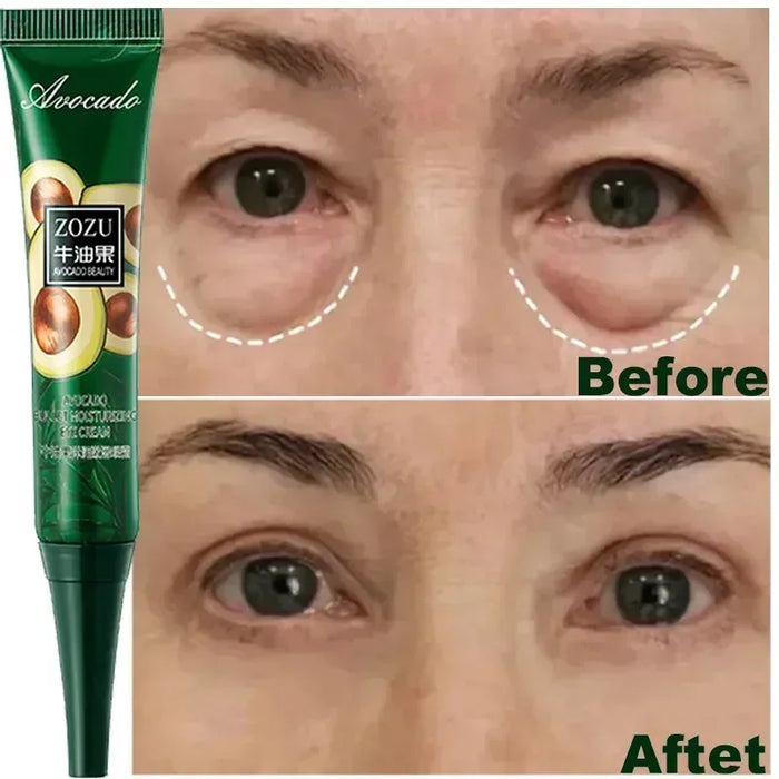 7 Day Tighten Wrinkles Eye Cream Anti Dark Circles Bags Puffiness Fade Eye Fine Line Whiten Under Eyes Skin Korean Care New 2024