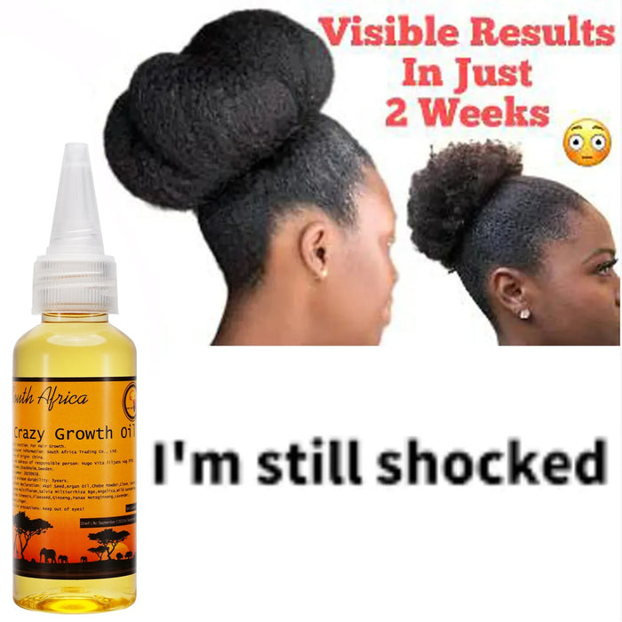 50 ml Traditional African Hair Oil GROW YOUR HAIR FASTER LONGER IN 1 WEEK Helps To Stop Breakage Moisturise Promotes Hair Growth