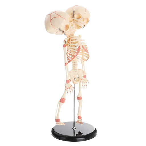 Double Head Baby Anatomy Skull Skeleton Anatomical Brain Anatomy Education Medical Model